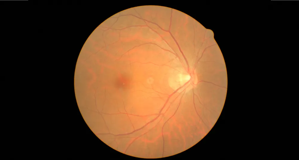 眼底検査・眼圧検査