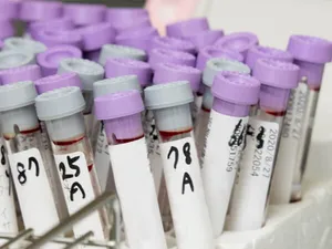 はらだ内科内視鏡健診クリニックの血液内科について